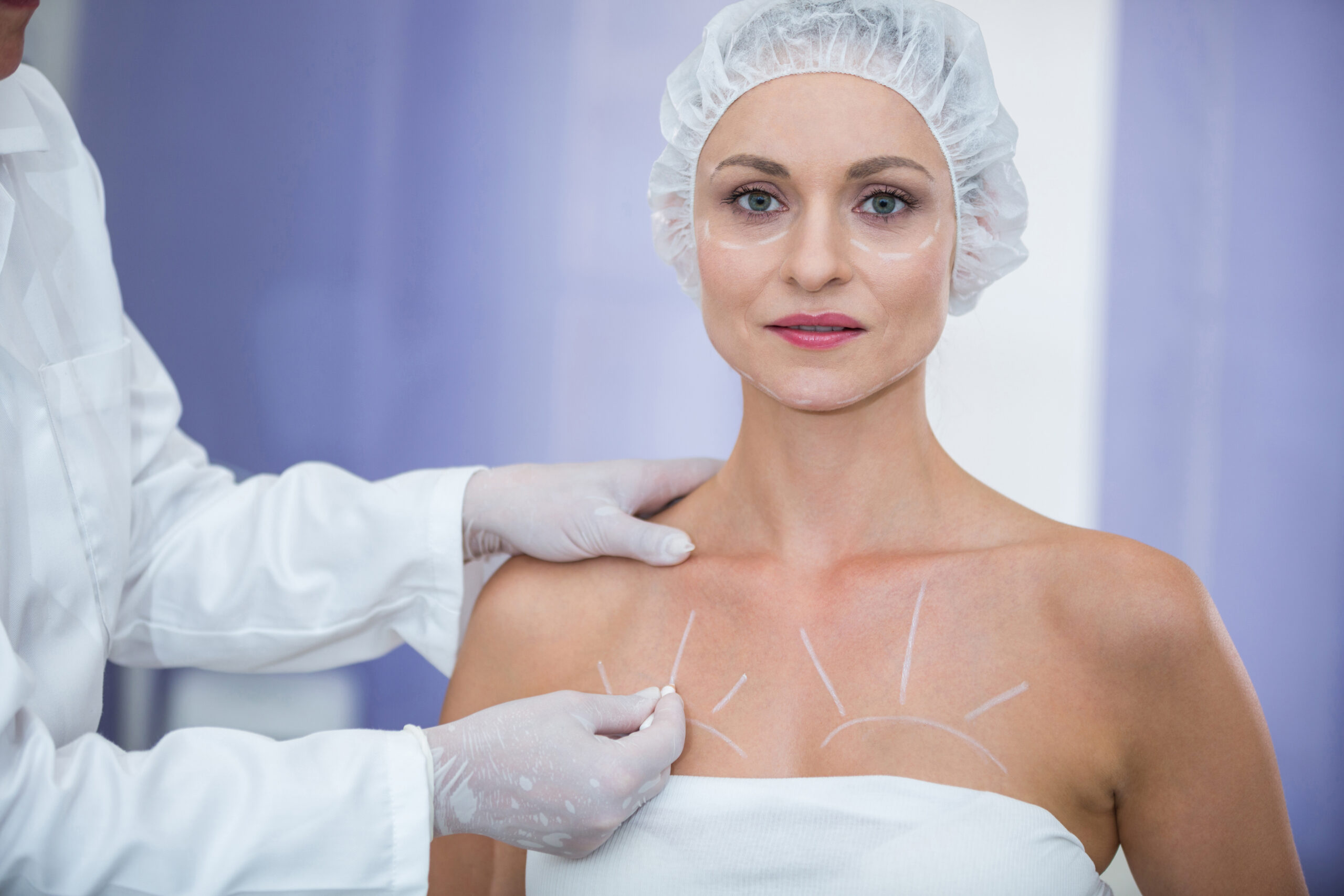 Mamoplastia redutora